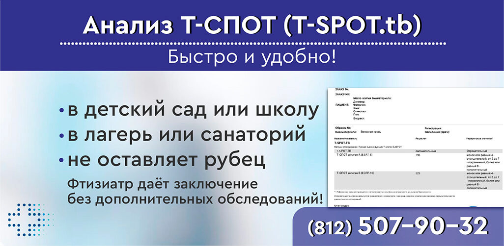 Результат анализа Т СПОТ (t-spot.tb) в СПб